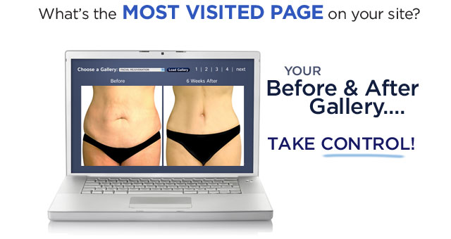 The most visited pages of your website are your before & after photos. Learn how to use this to your advantage.